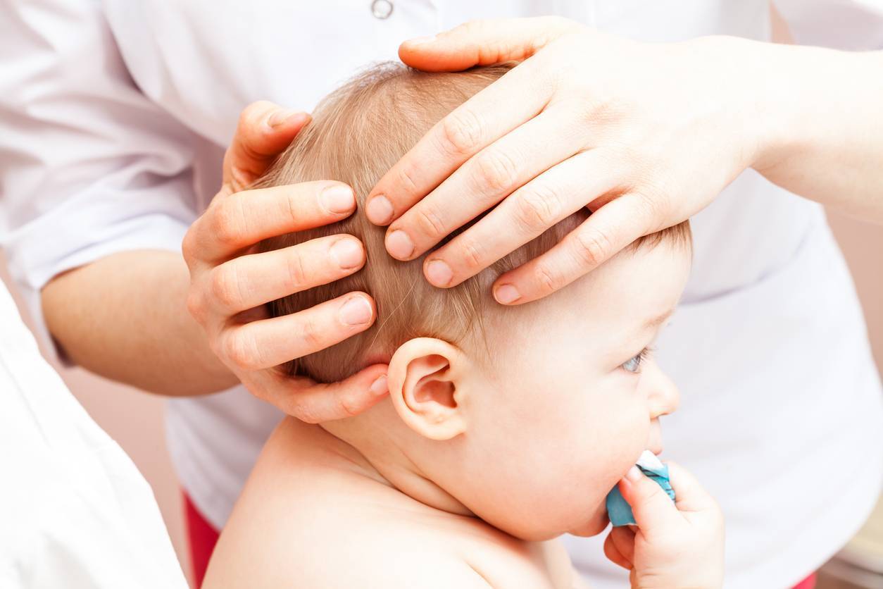 séance d'ostéopathie pour corriger une déformation cranienne