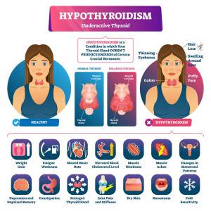 Hypothyroïdie et GROSSESSE : les réponses à vos questions 1